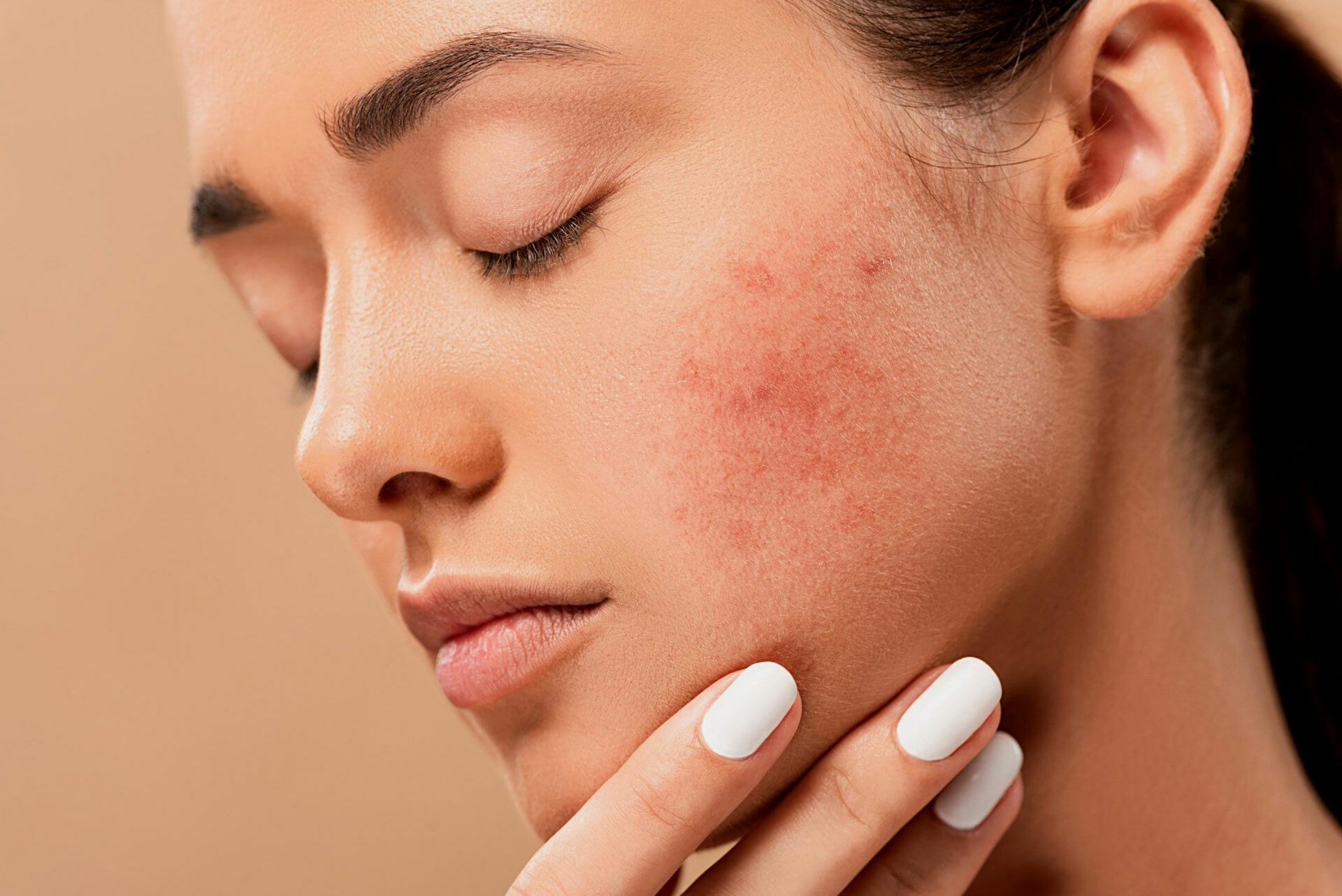 چگونه از خشکی پوست در پاییز جلوگیری کنیم ؟